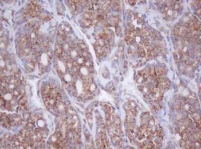 Immunohistochemistry: Mitocondrial Translational Initiation Factor 3 Antibody (OTI4B6) [NBP2-46034]