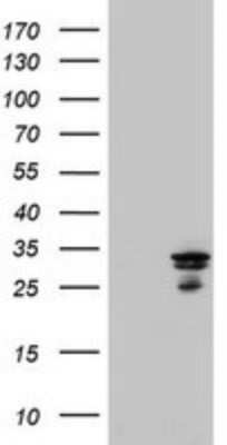 Western Blot: Mitocondrial Translational Initiation Factor 3 Antibody (OTI4B6) [NBP2-46034]