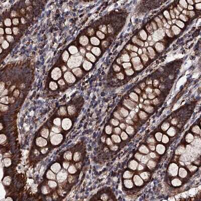 Immunohistochemistry-Paraffin: Mitocondrial Translational Initiation Factor 3 Antibody [NBP1-92121]