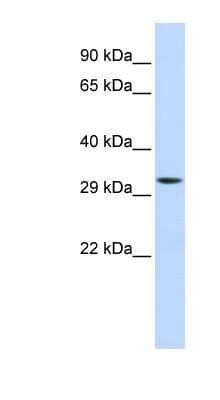 Western Blot: Mitocondrial Translational Initiation Factor 3 Antibody [NBP1-54978]