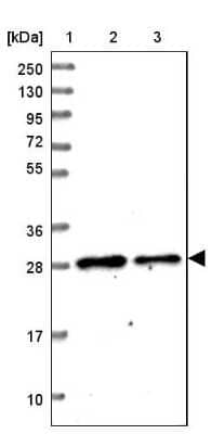 Western Blot: Mitocondrial Translational Initiation Factor 3 Antibody [NBP1-92121]