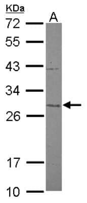 Western Blot: Mitocondrial Translational Initiation Factor 3 Antibody [NBP2-17297]