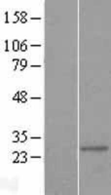 Western Blot: Mitocondrial Translational Initiation Factor 3 Overexpression Lysate [NBL1-13368]