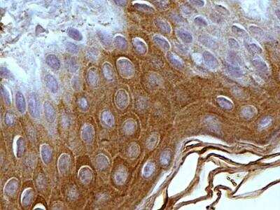 Immunohistochemistry-Paraffin: Mitofilin Antibody [NB100-1919]