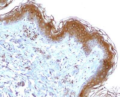 Immunohistochemistry-Paraffin: Mitofilin Antibody [NB100-1919]