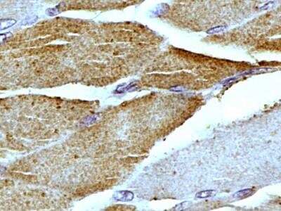 Immunohistochemistry-Paraffin: Mitofilin Antibody [NB100-1919]