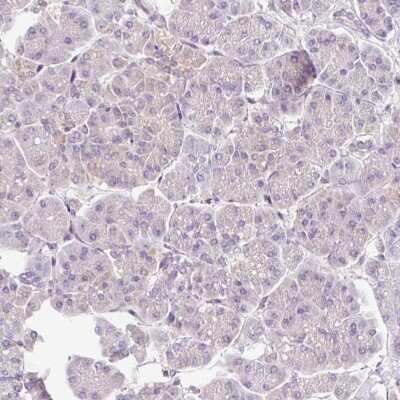 Immunohistochemistry-Paraffin: Mitofilin Antibody [NBP2-38285]