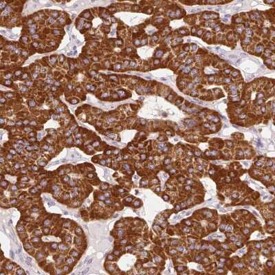 Immunohistochemistry-Paraffin: Mitofilin Antibody [NBP2-38285]