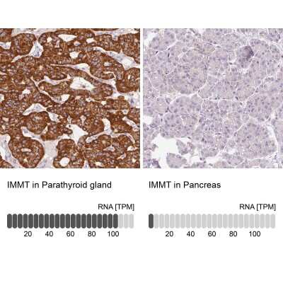 Immunohistochemistry-Paraffin: Mitofilin Antibody [NBP2-38285]