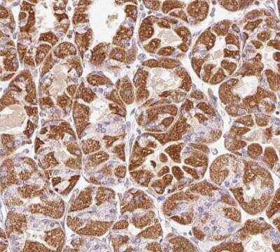 Immunohistochemistry-Paraffin: Mitofilin Antibody [NBP2-38286]