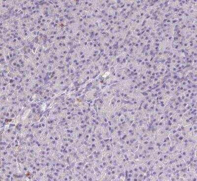 Immunohistochemistry-Paraffin: Mitofilin Antibody [NBP2-38286]