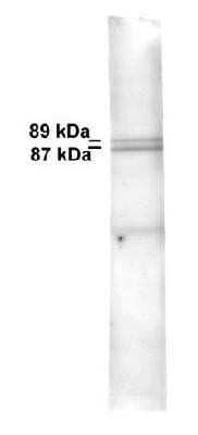 Western Blot: Mitofilin Antibody [NB100-1919]