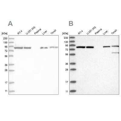 Western Blot: Mitofilin Antibody [NBP2-38285]