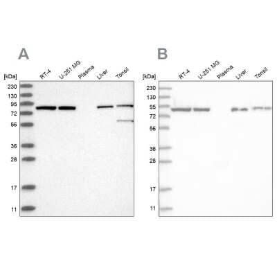 Western Blot: Mitofilin Antibody [NBP2-38286]