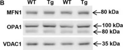 Western Blot: Mitofusin 1 Antibody (11E9-1H12)BSA Free [NBP1-71775]