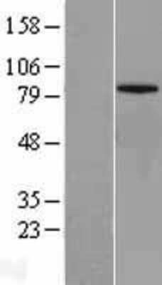 Western Blot: Mitofusin 1 Overexpression Lysate [NBL1-13039]