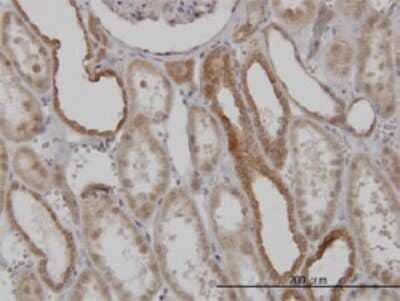 Immunohistochemistry-Paraffin: Mitofusin 2 Antibody (6A8) [H00009927-M01]