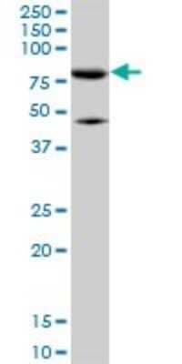 Western Blot: Mitofusin 2 Antibody (6A8) [H00009927-M01]