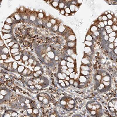 Immunohistochemistry-Paraffin: Mitofusin 2 Antibody [NBP1-85477]