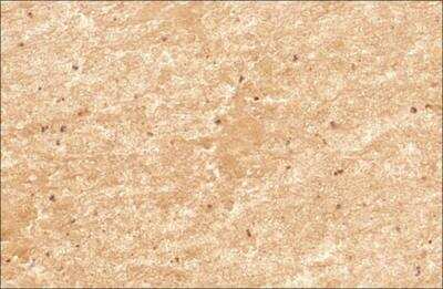 Immunohistochemistry-Paraffin: Mitofusin 2 Antibody - BSA Free [NBP2-66383]