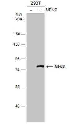 Western Blot: Mitofusin 2 Antibody [NBP2-17298]