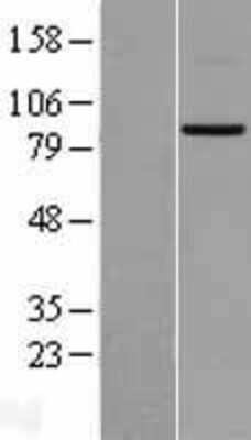 Western Blot: Mitofusin 2 Overexpression Lysate [NBL1-13040]