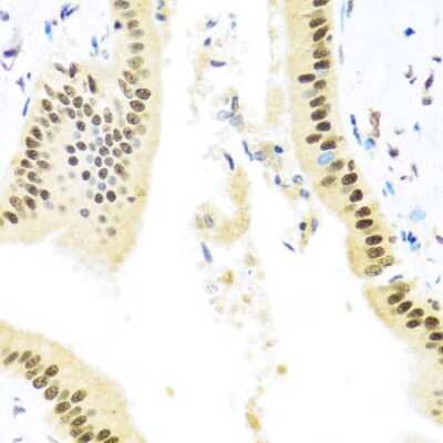 Immunohistochemistry-Paraffin: Miz-1/ZBTB17 Antibody - BSA Free [NBP3-03358]
