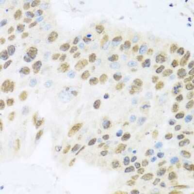 Immunohistochemistry-Paraffin: Miz-1/ZBTB17 Antibody - BSA Free [NBP3-03358]