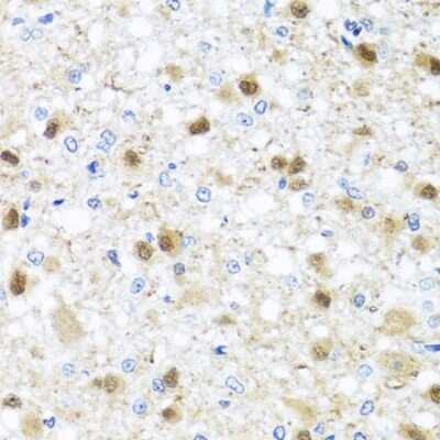 Immunohistochemistry-Paraffin: Miz-1/ZBTB17 Antibody - BSA Free [NBP3-03358]
