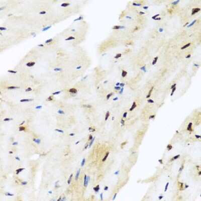 Immunohistochemistry-Paraffin: Miz-1/ZBTB17 Antibody - BSA Free [NBP3-03358]