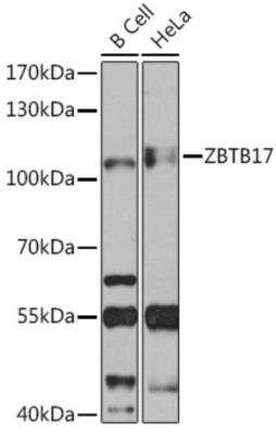 Western Blot: Miz-1/ZBTB17 AntibodyBSA Free [NBP3-03357]