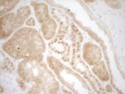 Immunohistochemistry: Mkl1 Antibody (OTI3G7) [NBP2-45862]