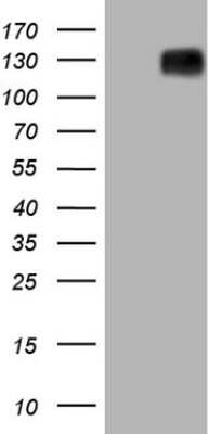 Western Blot: Mkl1 Antibody (OTI3G7) [NBP2-45862]