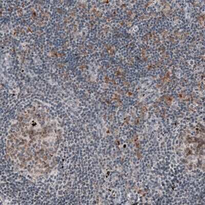 Immunohistochemistry-Paraffin: Mkl1 Antibody (CL4281) [NBP2-59047]