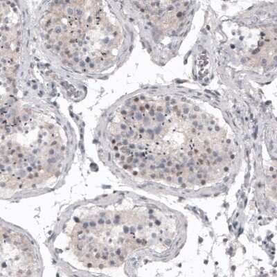 Immunohistochemistry-Paraffin: Mkl1 Antibody (CL4281) [NBP2-59047]
