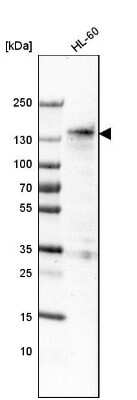 Western Blot: Mkl1 Antibody (CL4281) [NBP2-59047]