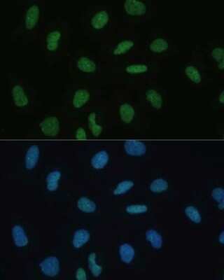 Immunocytochemistry/ Immunofluorescence: Mkl1 Antibody - BSA Free [NBP3-04625]