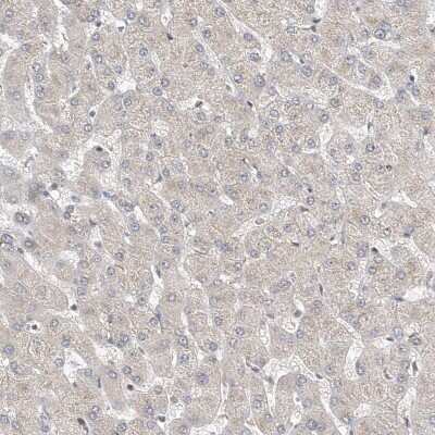 Immunohistochemistry-Paraffin: Mkl1 Antibody [NBP1-88498]