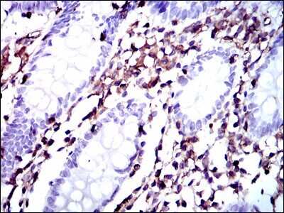 Immunohistochemistry: Moesin Antibody (2C12) - BSA Free [NBP2-37509]