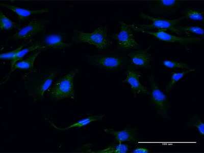 Immunocytochemistry/ Immunofluorescence: Moesin Antibody (4B8) [H00004478-M13]