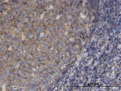 Immunohistochemistry-Paraffin: Moesin Antibody (4B8) [H00004478-M13]