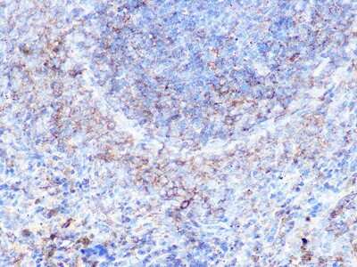 Immunohistochemistry-Paraffin: Moesin Antibody (6G0N7) [NBP3-16513]
