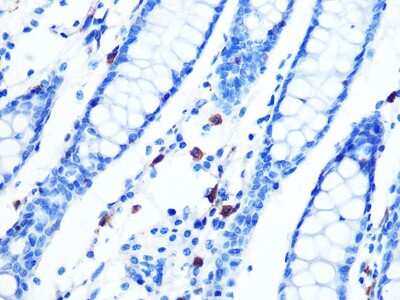 Immunohistochemistry-Paraffin: Moesin Antibody (6G0N7) [NBP3-16513]