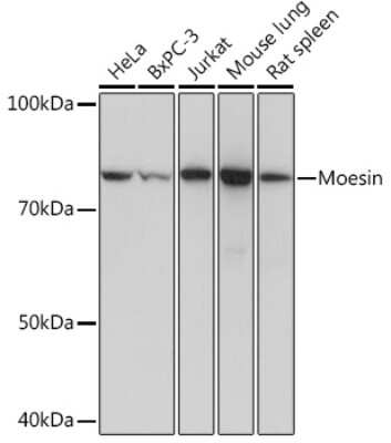 Western Blot: Moesin Antibody (6G0N7) [NBP3-16513]