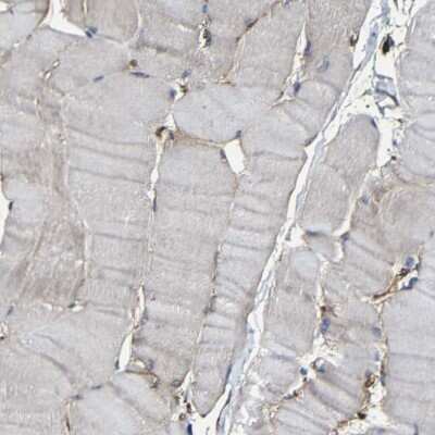 Immunohistochemistry-Paraffin: Moesin Antibody [NBP1-90372]