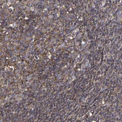 Immunohistochemistry-Paraffin: Moesin Antibody [NBP1-90372]