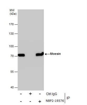 Immunoprecipitation: Moesin Antibody [NBP2-19376]