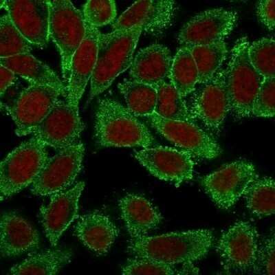 Immunocytochemistry/ Immunofluorescence: Moesin Antibody (MSN/491) - Azide and BSA Free [NBP2-34685]