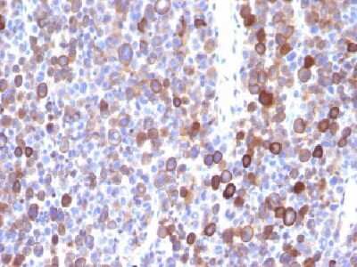 Immunohistochemistry-Paraffin: Moesin Antibody (MSN/491) - Azide and BSA Free [NBP2-34685]