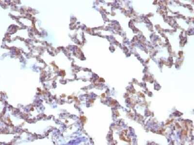 Immunohistochemistry-Paraffin: Moesin Antibody (MSN/491) - Azide and BSA Free [NBP2-34685]